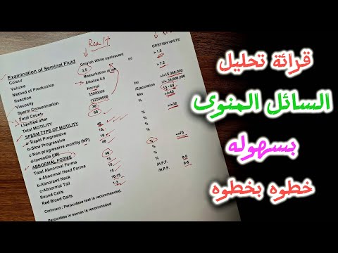 افضل طريقة لقرائة تحليل السائل المنوى خطوة بخطوة
