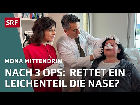 Botox, breast augmentation, and rhinoplasty – How far will we go for beauty? | Mona in the thick ...