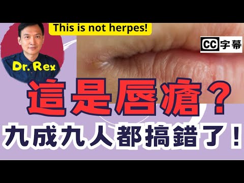 (AI中文字幕/Eng Sub)嘴角出現這種問題,其實不是唇瘡?this is not herpes!