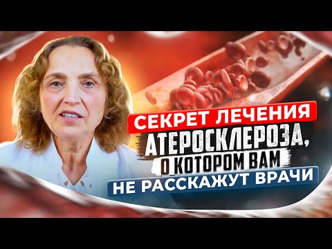 Как лечить атеросклероз
