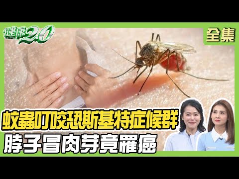 IU罹不治之症皮膚壞死沒知覺!蚊蟲叮咬2症狀恐斯基特症候群!婦脖子冒肉芽竟罹癌!健康2.0 20250406【完整版】#陳欣湄 #韋汝 #趙昭明 #吳吉妮 #胡逸惟 #余雅雯 #陸巧因
