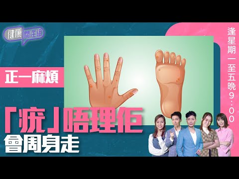 健康關注組|正一麻煩「疣」唔理佢會周身走!|HOY TV 77台|敖嘉年|梁嘉琪|第90 集
