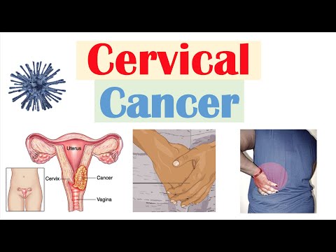 Cervical Cancer: Risk Factors, Pathophysiology, Symptoms, Staging, Diagnosis, Treatment & Prevention