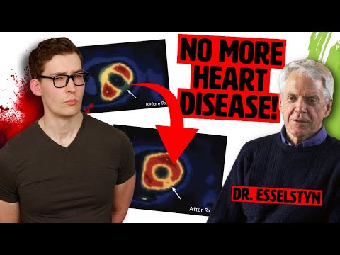 Dr. Esselstyn: No Oil, No Heart Disease