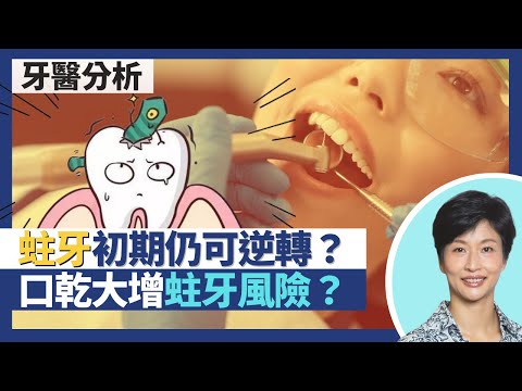 蛀牙|口乾增加蛀牙風險?4大因素引致蛀牙 解構蛀牙過程!治療蛀牙不只補牙 蛀牙初期仍可逆轉|王建芳醫生 牙科醫生李錦賓醫生|人類健康研究所