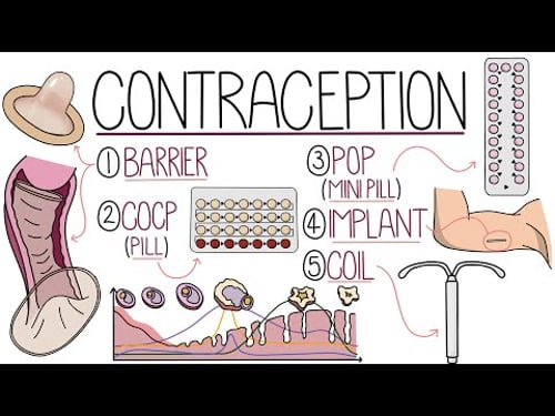 Methods of Contraception Made Easy (Contraceptive Methods Explained)