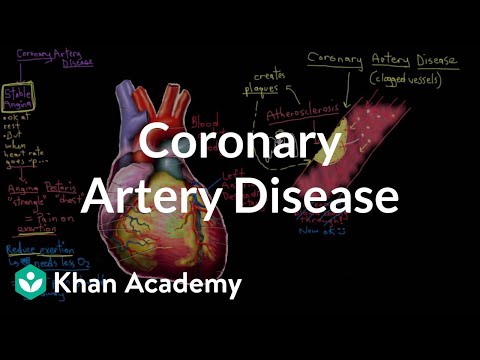 What is coronary artery disease? | Circulatory System and Disease | NCLEX-RN | Khan Academy