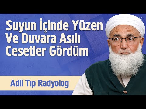 Suyun İçinde Yüzen Ve Duvarda Asılı Cesetler Gördüm