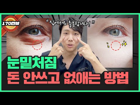 Under-eye Bags and Sagging! Don't Spend Money, Get Rid of Them at Home! | Reasons for Puffy Under...