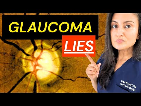 Glaucoma Specialist Reveals Truth About Glaucoma | Glaucoma Facts