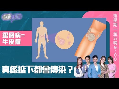 健康關注組 | 銀屑病=牛皮癬 真係掂下都會傳染? | HOY TV 77台 | 敖嘉年 | 梁嘉琪 | 林曉蕙 | 第42集