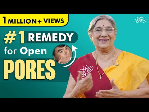 How to treat OPEN PORES | Enlarged Pores - Causes & Treatment | Natural Skincare Remedies