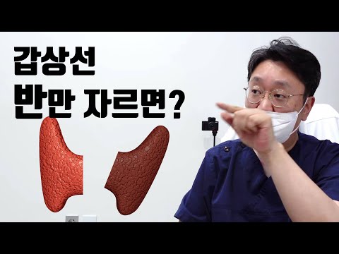 갑상선 반만 자르면? (갑상선암 반절제)
