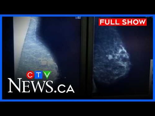 Doctors worried about higher wait times | CTV News Calgary at 5 for April 22, 2026