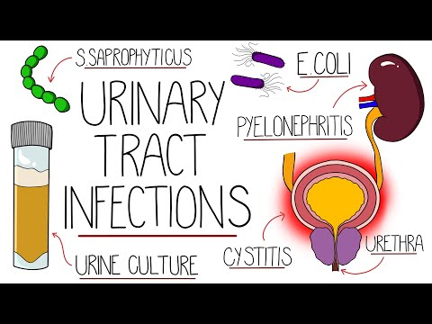 UTI Made Easy - Urinary Tract Infections Explained Clearly