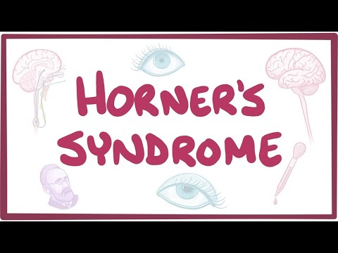 Horner's syndrome - causes, symptoms, diagnosis, treatment, pathology