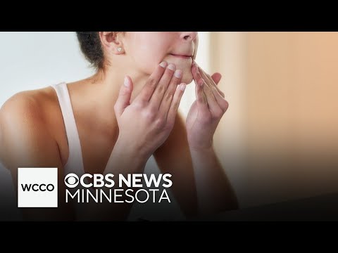 Why this popular TikTok trend is concerning doctors