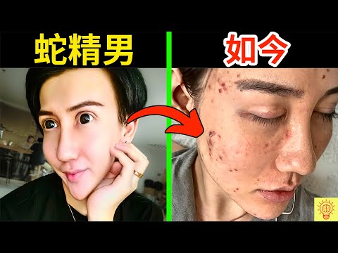 網紅【蛇精男】如今怎樣了?臉爛毀容、萬億流量歸零、被罵到停播!人設崩塌現場畫面曝光!