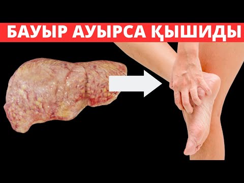 Бауыр ауырса АЯҚ ҚЫШИДЫ и осы ЖАРАЛАР шығады. Бауыр ауырса не истеу керек