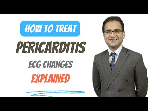 Pericarditis Symptoms, Treatment, ECG Changes, Pathology, Explained, Medicine Lecture, USMLE NEETPG