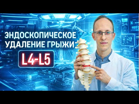 Самая малоинвазивная операция на позвоночнике по удалению грыжи диска