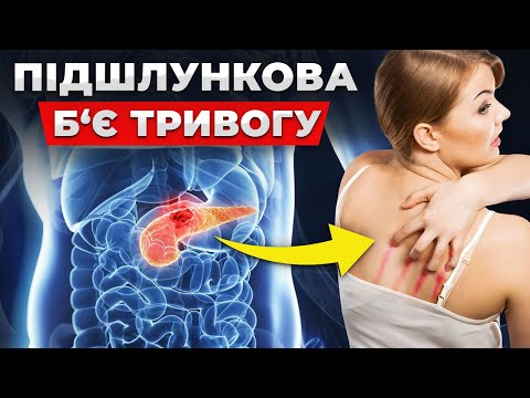 ЦЕ перші ознаки ПРОБЛЕМ з підшлунковою! Симптоми та ПРАВИЛЬНЕ лікування!