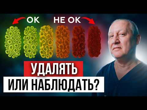 Рак простаты: стадии, шкала Глисона и как понять, чем лечить