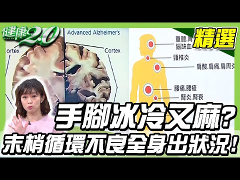 手腳冰冷又麻?活化你的末梢血液循環,專家激推這樣吃這樣動!【健康2.0精選】