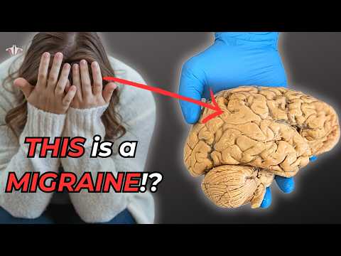 Why Migraines Are More Than Just a Headache