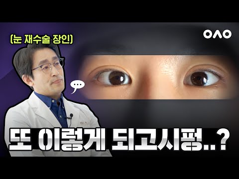 쌍수 망치고 돈 날린 사람들 다 드루와!!! 재수술 Grand Master 가 알려주는 눈 재수술 성공하는 법! ep.40
