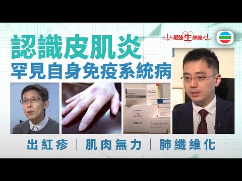 最強生命線|皮肌炎成因未明 壓力、病毒感染、遺傳可增病發風險 把握診斷治療時機至關鍵 (繁 / 簡字幕)|醫療|治療|無綫新聞 TVB News