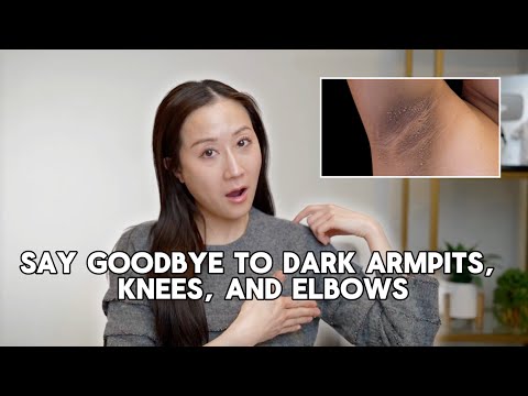 Tips for getting rid of body hyperpigmentation | Dermatologist Dr. Jenny Liu