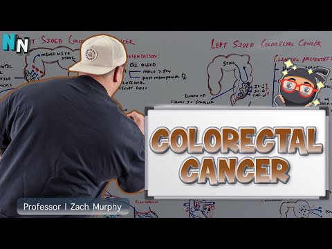 Colorectal Cancer | Clinical Medicine