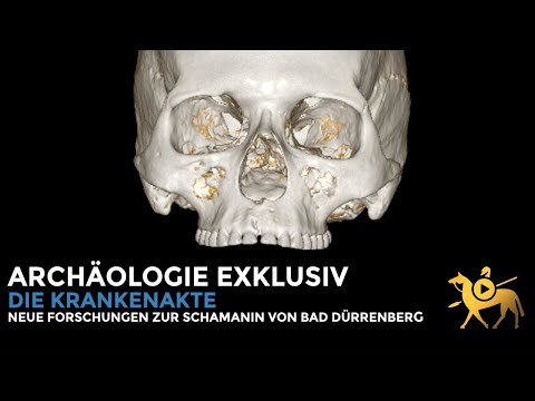 The Bad Dürrenberg shaman: Medical records | Archäologie exklusiv