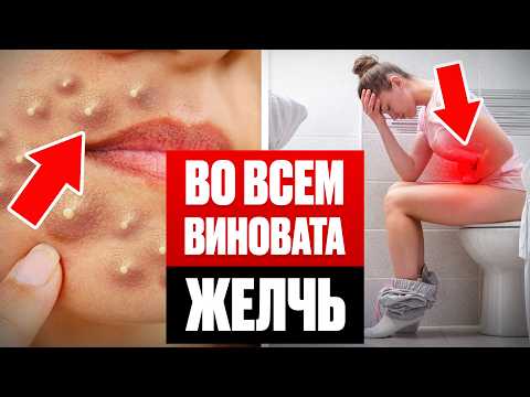 10 Hidden Signs of Bile Stagnation and How to Get Rid of It