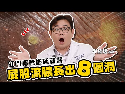 痔瘡 肛裂 瘻管!遇到肛門三寶,反覆發作好不了? 治療方法一次告訴你!|ft. 邱騰逸 醫師 童綜合醫院 大腸直腸外科