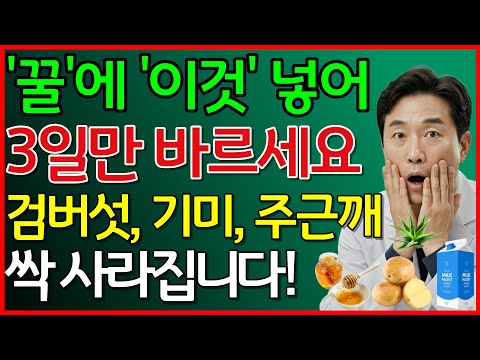 꿀에 이것 넣어 3일만 바르세요 검버섯, 기미, 주근깨 싹 사라집니다 #기미없애는법 #검버섯없애는법 #천연팩