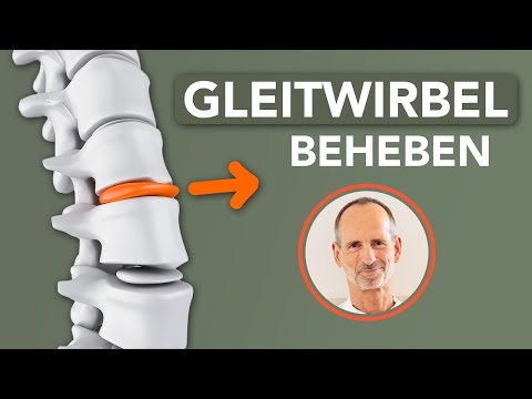 Was du bei Gleitwirbel tun kannst, um dir selbst zu helfen (gegen Rückenschmerzen)