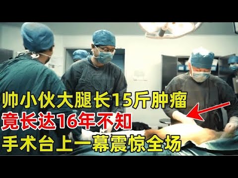 帅小伙腿部长15斤巨大肿瘤,竟长达16年,面临截肢,医生一句话震惊全场【生命缘】
