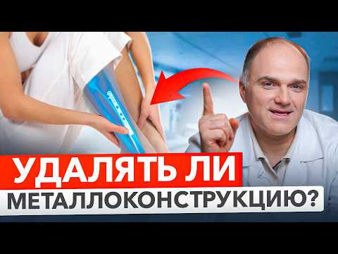 Что будет если не удалять ПЛАСТИНЫ, ВИНТЫ после срощения перелома перелома?