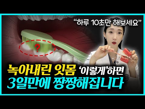 이거 모두가 알면 치과 망해요ㅠㅠ 잇몸을 회복 시켜주는 신기한 양치질 방법!