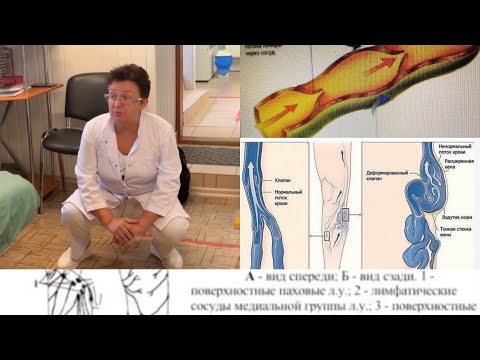 Problems in the knees and hip joints are an indicator of serious problems in the body, be warned