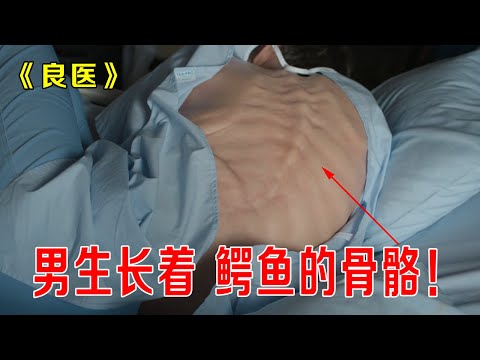 男生长着鳄鱼骨骼,被学生称为“鳄鱼男孩,罪魁祸首竟然是学校《良医》