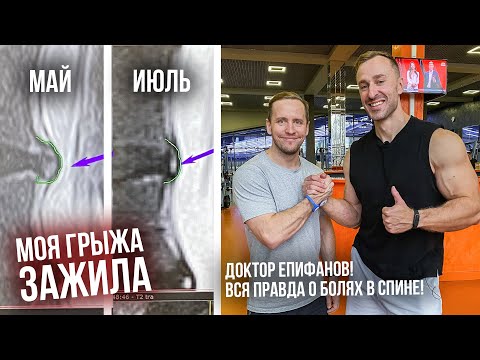 Правильные тренировки при болях в спине и вся правда о грыжах! Доктор Антон Епифанов