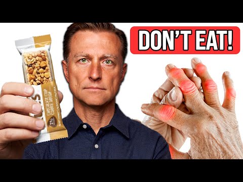 STOP Eating These 7 Foods if You Have Arthritis (& What to Eat Instead)