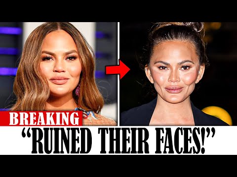 8 Hollywood Stars Who RUINED Their Face With Buccal Fat Removal