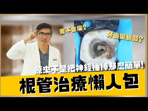 【蛀牙 #6】根管治療是什麼?治療一定要抽神經嗎😱😱顯微根管治療為什麼比較厲害?|【祐民牙醫-隱適美旗艦店】鑽石級楊大為醫師