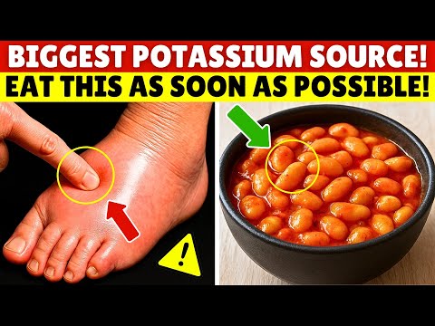 Goodbye Swelling! 8 Potassium Rich Foods You MUST Eat To Drain Fluid FAST | Senior Health Tips
