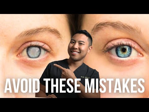 Cataract Surgery in One Eye? Avoid These 3 MISTAKES