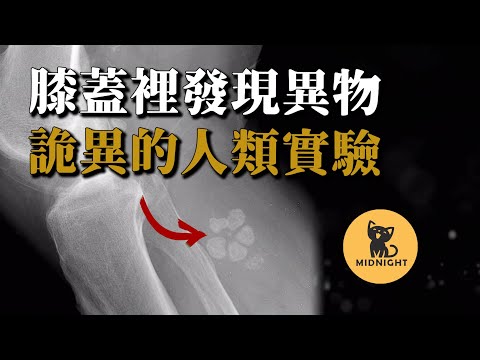 跑步膝蓋疼痛,檢查發現駭人物體,竟然與35年前的詭異遭遇有關?